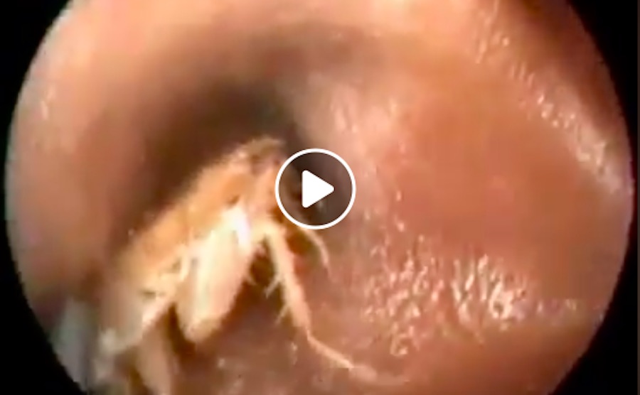 finder bille i drengs øre
